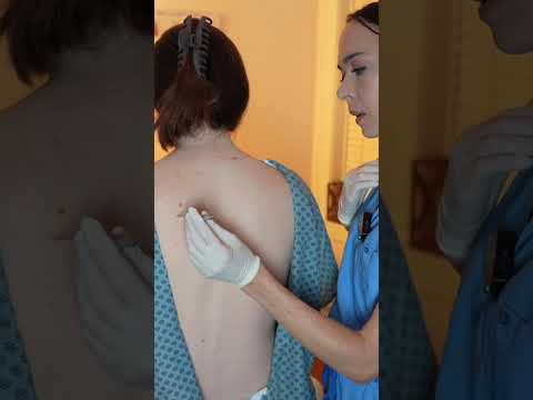 asmr chiro #asmr #asmrsounds #asmrvideo #relaxing #relax #satisfying #satisfyingvideo #tingles