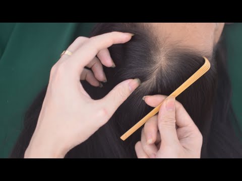 ASMR Scalp Scratch No Talking, Aggressive Scratching On Real Person, Hair Sounds For Stress Relief