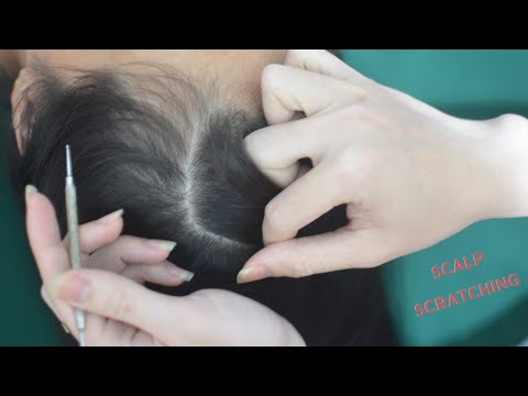 ASMR Real Person Hair Parting And Scalp Scratch Sounds, Tingly Therapy For Headache Relief