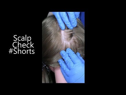 ASMR Tingly Scalp Check #Shorts